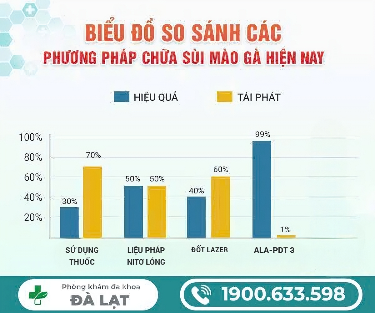 Hình ảnh minh họa